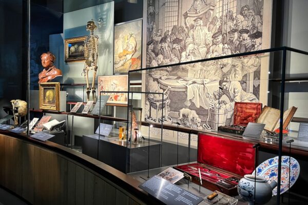 Das Hunterian Museum ist besonders für seine umfangreiche Sammlung von medizinischen Präparaten bekannt. Daneben zeigt die Ausstellung aber auch historische Dokumente, medizinische Instrumente und Kunstwerke.