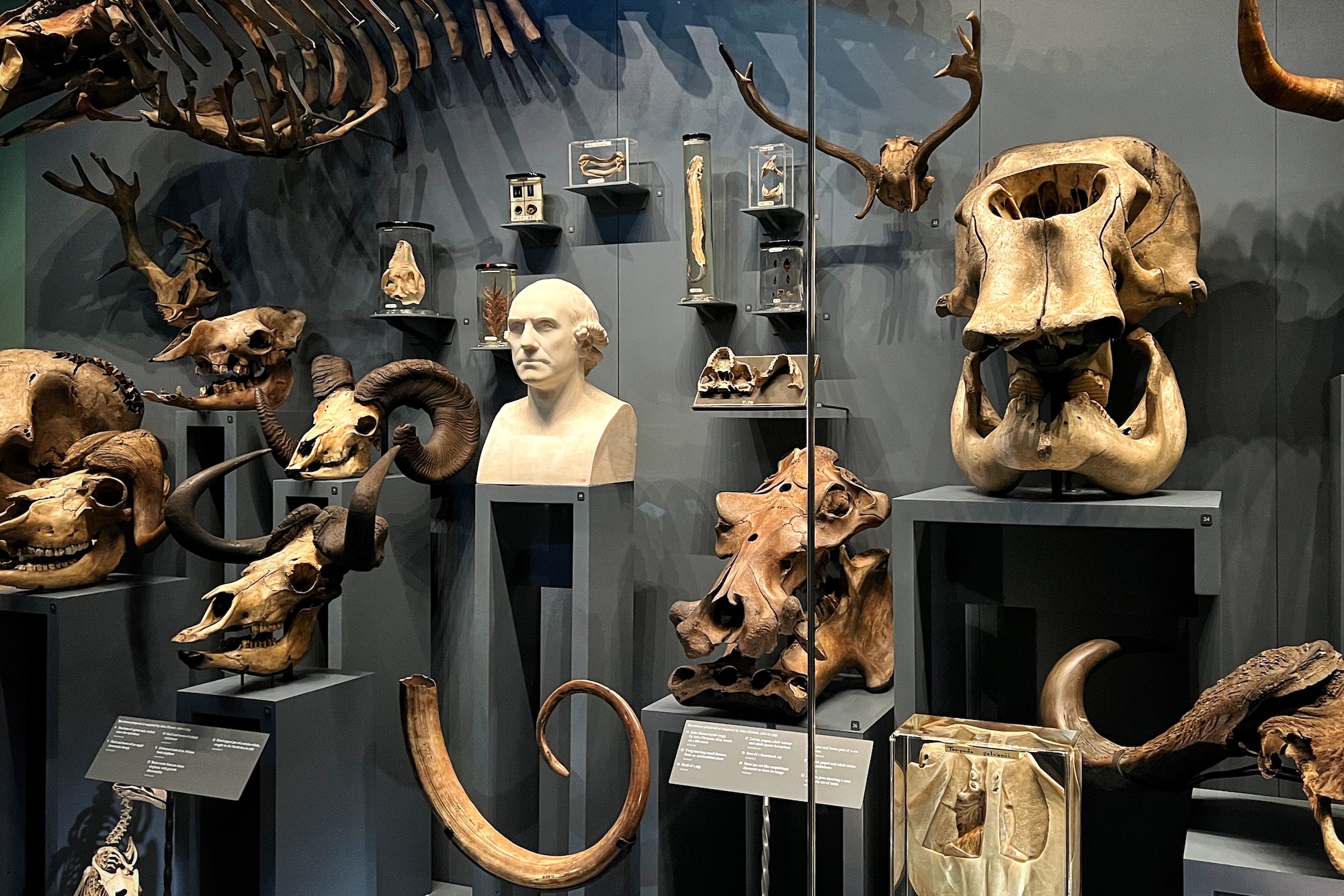 Das Hunterian Museum in London setzt sich damit auseinander, wie eine medizinhistorische Sammlung zeitgemäß präsentiert werden kann.